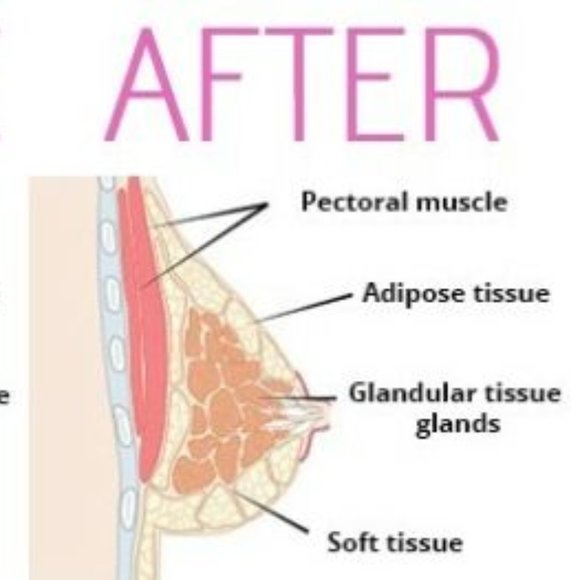 Natural Breast Enhancement Enlargement Cream - Picture 6 of 9